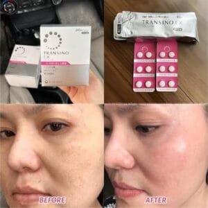 Transino Ex Whitening Tablet